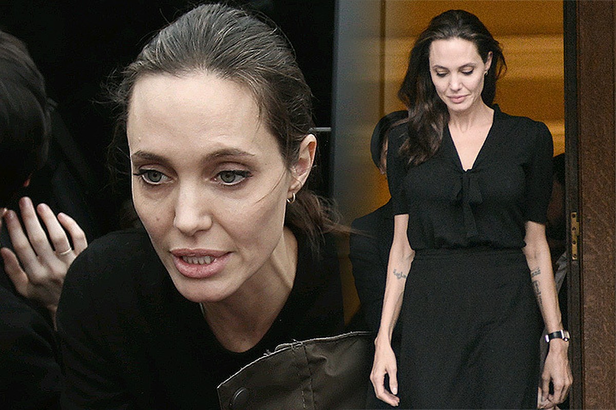 Angelina Jolie's Lip Job: Truth or Rumor?